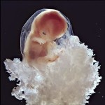 feto-10-settimane
